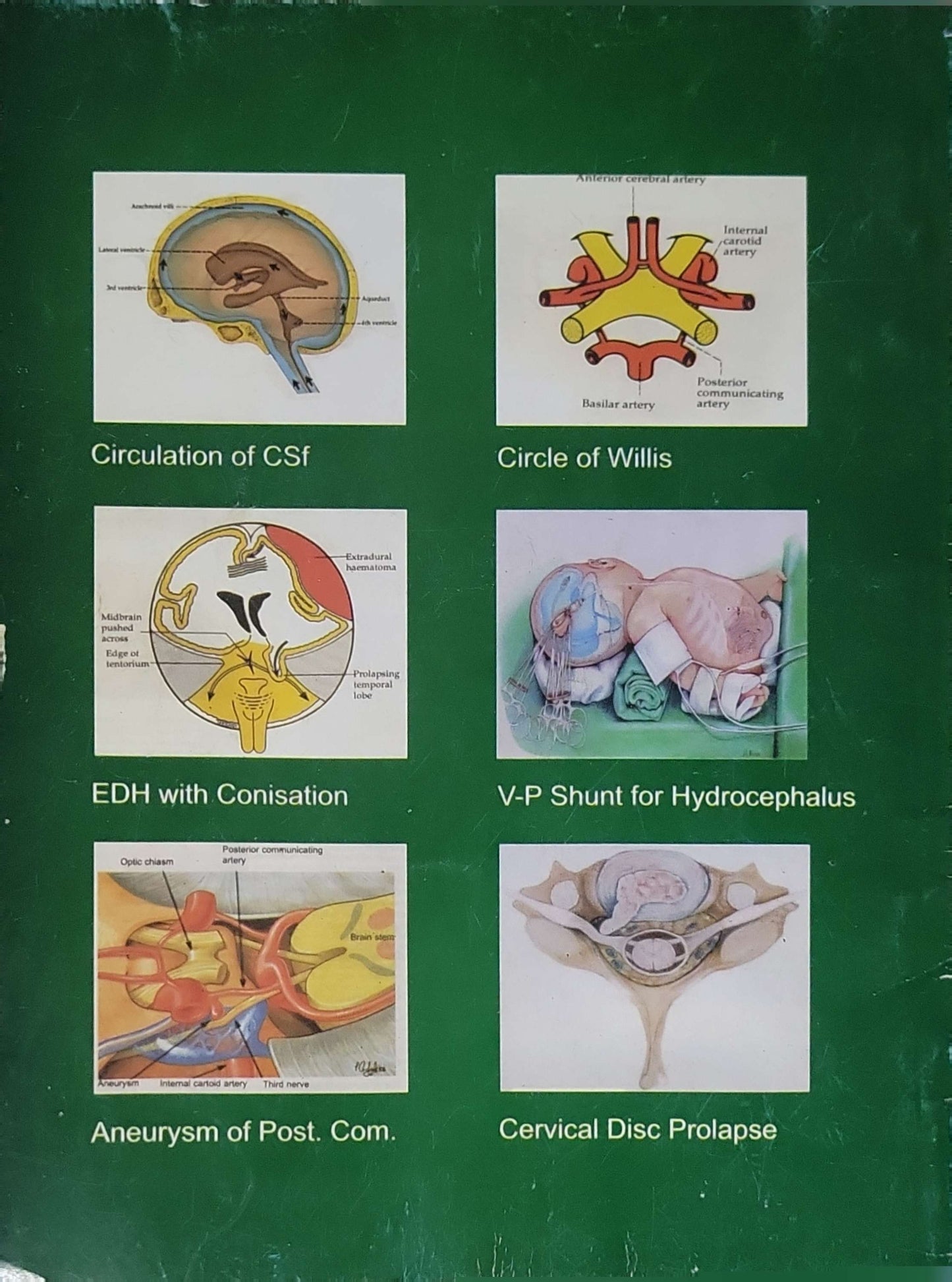 Essentials of Neurosurgery: For the Undergraduate By Basim Ayoub