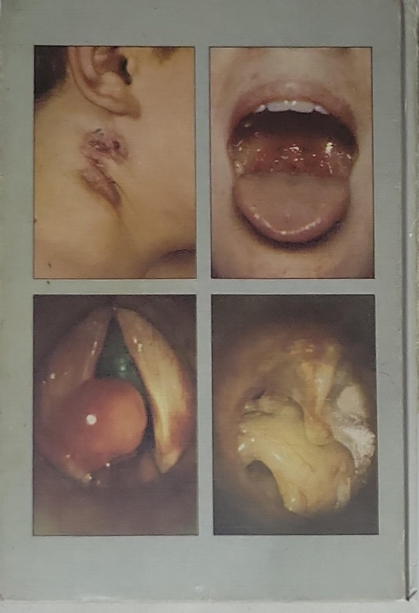 A colour atlas of E.N.T. Diagnosis