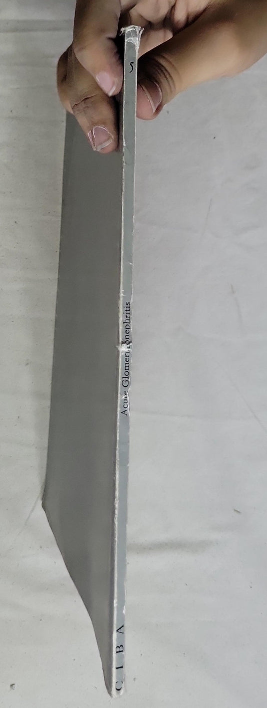 Acute Glomerulonephritis