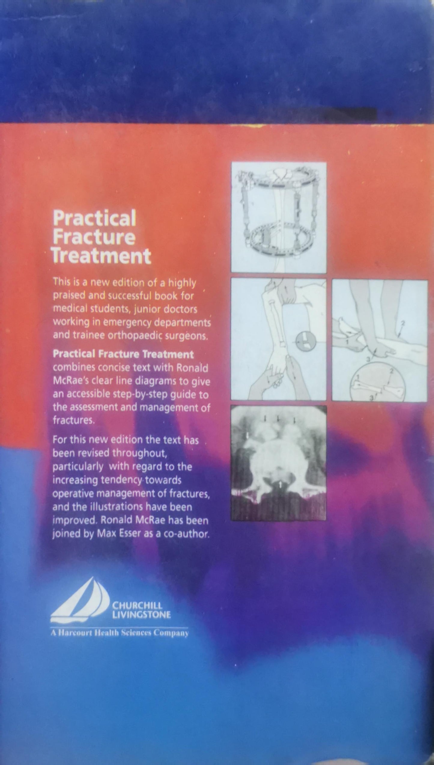 Practical Fracture Treatment By Ronald McRae and Max Esser