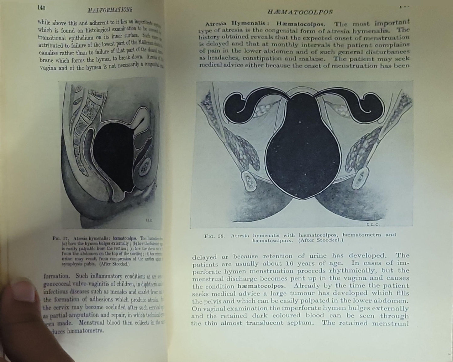 Textbook of Gynaecology