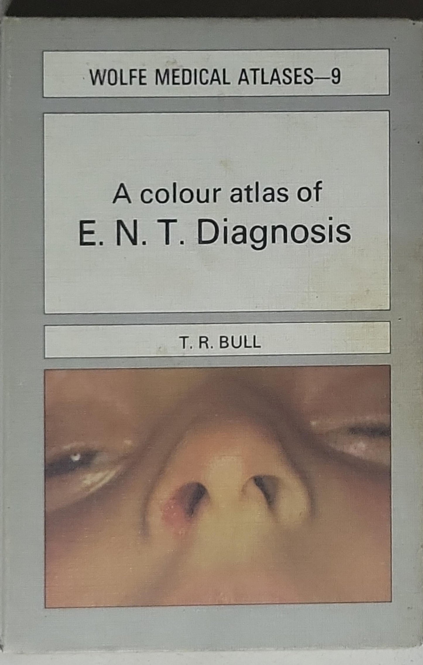 A colour atlas of E.N.T. Diagnosis