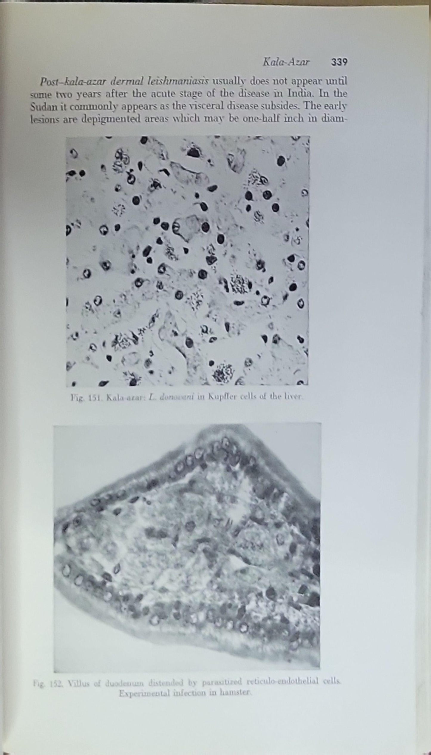 A Manual of Tropical Medicine