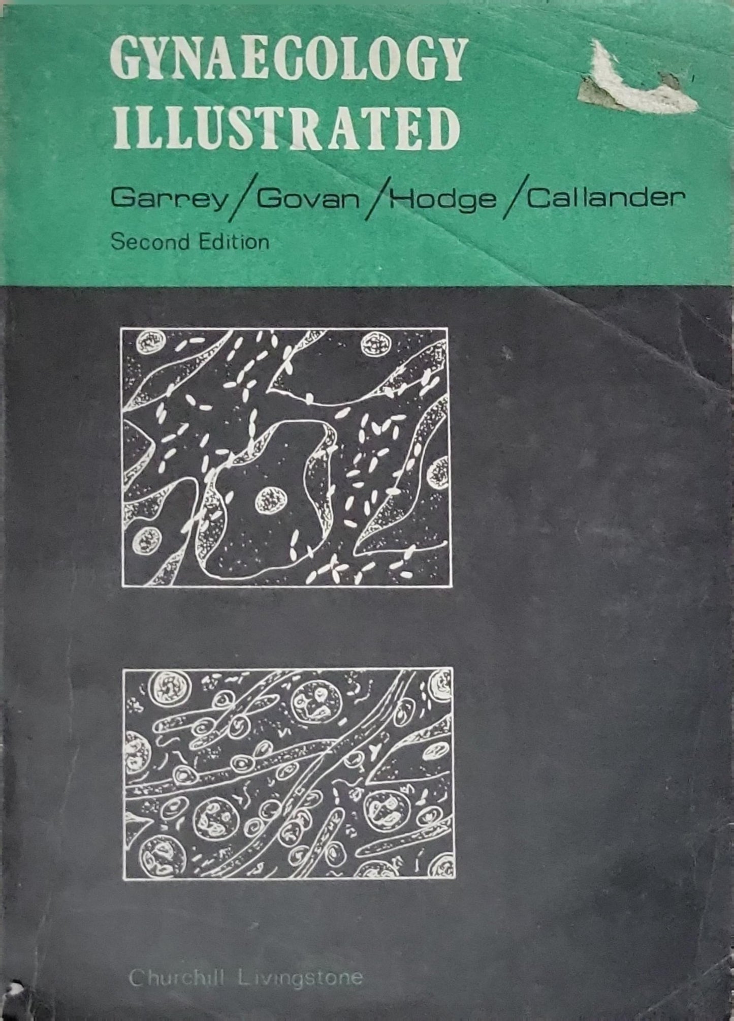 Gynaecology Illustrated: Second Edition By Garrey and Govan and Hodge and Callander