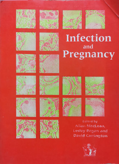 Infection and Pregnancy By Allan MacLean and Lesley Regan and David Carrington