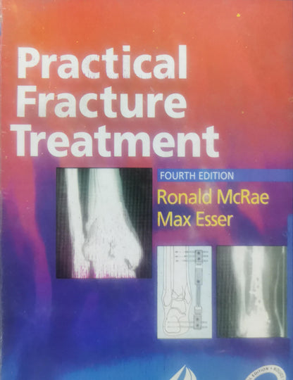 Practical Fracture Treatment By  Ronald McRae and  Max Esser