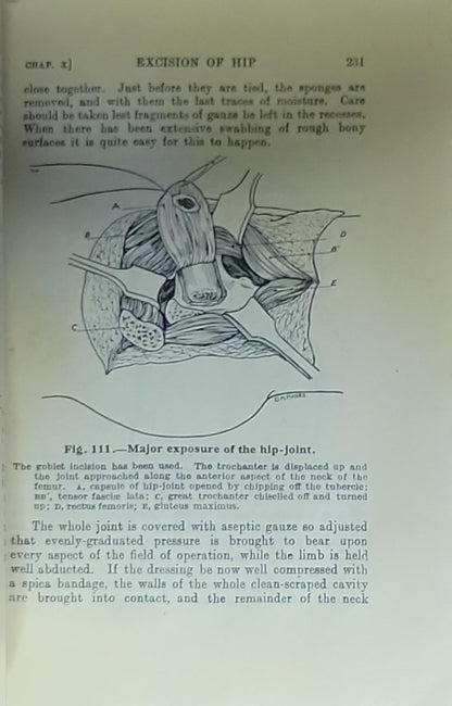 The Student's Handbook of Surgical Operations